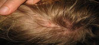 من رأى في منامه أنه يشترى ساعة يد فهذه بشارة خير ودلالة على تحقيق الأمنيات وخاصة إن كانت ساعة اليد لونها ذهبياً كما تدل على أن تفسير إهداء ساعة اليد في المنام. Ø§Ù„Ù‚Ù…Ù„ ÙÙŠ Ø§Ù„Ù…Ù†Ø§Ù… Ø¨Ø´Ø§Ø±Ø© Ø®ÙŠØ±