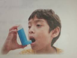 A person inhabiting the environment of high atmospheric pressure develops  with respiratory disorder a.Embolous b.bronchitis c.pulmonary oedema  d.Emphysema