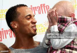 246 Progeria Stock Photos, High-Res Pictures, and Images