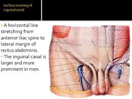 The inguinal hernia occurs when a section of the small intestine or fat pocket from the abdomen snakes down into the tubular canal that runs through the abdominal wall and pops out of a weakness in the peritoneum. Inguinal Canal