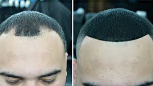 25.john is collecting rubbish, …? How To Cover Up Bald Spots Youtube