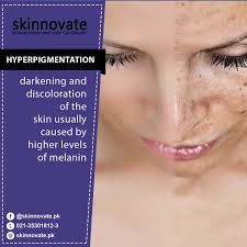 Skinnovate Dermatology and Hair Transplant (@the_skinnovate_official) ·  Instagram photos and Reels