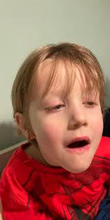 My son keeps sitting like this after eating and there is usually some food  inside his mouth/on the back of his tongue. He will sit like this for hours  and hours and