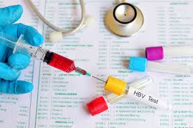 We did not find results for: Blut Fur Hepatitis B Virus Hbv Test Lizenzfreie Fotos Bilder Und Stock Fotografie Image 50645454