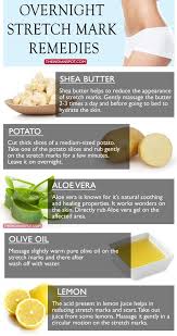 The Best Way To Remove And Get Rid Of Stretch Marks Naturally On Arms Thighs And Stomach Is To Moisturize So Stretch Mark Remedies Stretch Marks Skin Remedies