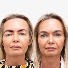 Array Aesthetics in Windsor, Belfast • Read 12 Reviews