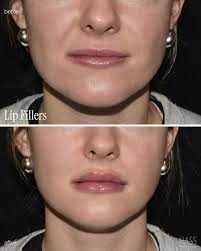 Hass Plastic Surgery & MedSpa (@hassplasticsurgery) • Instagram photos and  videos