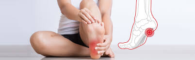 What are the best exercises for heel pain? Plantar Fasciitis Pain Relief Team Chiropractic Sports Medicine
