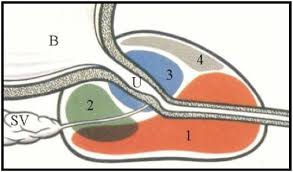 Does blood cancer run in families? Figure 5 Endotext
