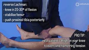 Image result for PCL Sulcus Test