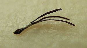 Chemical services are responsible for the majority of hair loss in the absence of an underlying medical condition. Pili Multigemini Wikipedia