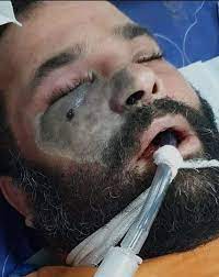 حب اعمي الجزء الثاني ( مدبلج ). Szplxdoicbcczm