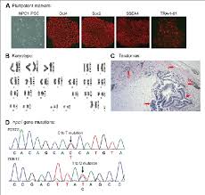It is quite different from most other dementias. Generation Of Niemann Pick Disease Type C1 Npc1 Induced Pluripotent Download Scientific Diagram