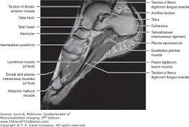 The aim of this review is to provide the reader with a comprehensive overview of the magnetic resonance imaging (mri) characteristics of the most common benign and malignant soft tissue neoplasms which occur around the foot and ankle. Foot Anatomy Mri Anatomy Drawing Diagram