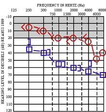 How to read an audiogram asha. How To Read An Audiogram First Steps