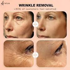 Qırışlara Qarşı Dəri Rebounce Nəmləndirici Balzam