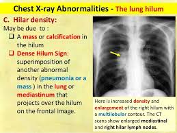 Sxetikh Eikona Radiology Imaging Respiratory Therapy Notes Radiology