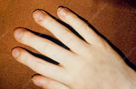 Image result for Digital Clubbing