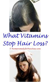 Hair Loss Uk Help Hair Loss Scalp Hair Loss Hair Loss Medication
