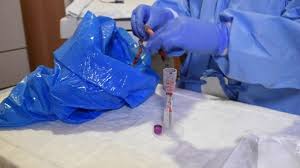 Cord blood is only collected after the baby is born and the cord is clamped and cut. Umbifunnel An Umbilical Cord Blood Collection Device Youtube