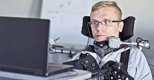 How Is Als Diagnosed And Treated Als Program At Hss