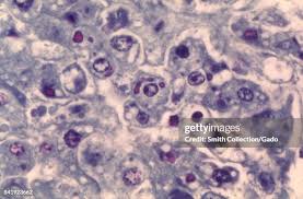 Image result for Filoviridae