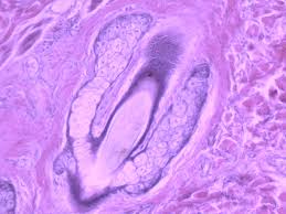 Image result for Sebaceous Gland
