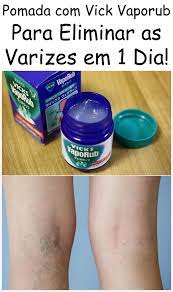 Pomada Com Vick Vaporub Para Eliminar As Varizes Em 1 Dia Vicks Vaporub Vicks Vaporub Uses Vicks