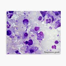 Maybe you would like to learn more about one of these? Toxoplasma Gondii Ein Protozoenparasit Fotodruck Von Bpritt Redbubble