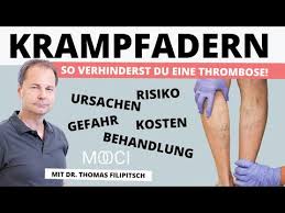 Die meisten menschen haben von einer krankheit wie krampfadern gehört oder wissen davon. Krampfadern Kosten Risiken Behandlung Mooci