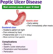 Rosh Review Peptic Ulcer Gastrointestinal Nursing Nurse