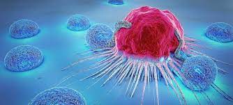 Cancer often has the ability to spread throughout your body. New Cure For Cancer Moffitt
