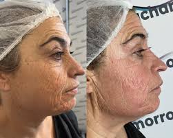 Ana Chamorro Estética...