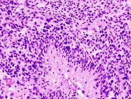 Pin On Histopath