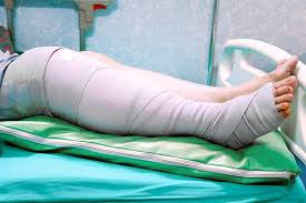 Image result for Compartment Syndrome