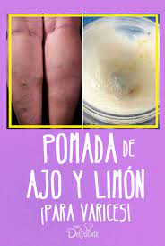 Como Hacer Pomada Para Las Varices