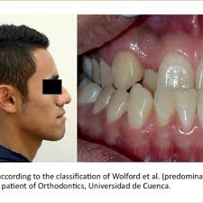 Manuel BRAVO CALDERÓN