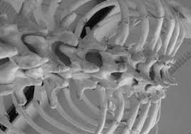 Se l'acido urico sale, potrebbe essere causato da una dieta troppo ricca in purine. Dieta Per Controllo Acidi Urici Rischio Gotta Artrite Osteoporosi