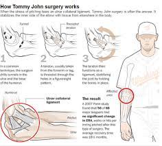 A ucl is a ligament on the inner side of your elbow that helps secure your elbow joint. Baseball S Golden Arms On Point