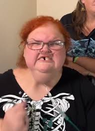 The show should pay for Tammy's teeth to be fixed : r/1000lbsisters