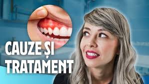 Retracția Gingivală cu Dr. Dragoș Vulcu