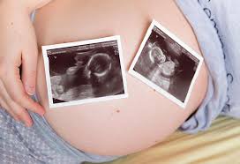 By zaira salvador bsc, msc (embryologist). Twin Pregnancy Week 24 Symptoms Baby Size Body Changes More