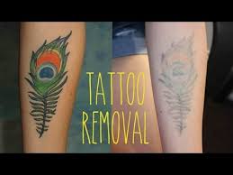 Regular exfoliation regular exfoliation is essential to get rid of the dry, flaky skin and reveal the fresh layer of skin underneath between your eyebrows. How To Remove A Tattoo The Most Effective Treatment Youtube