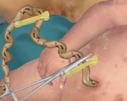 Natural Child Birth Surgery Squad