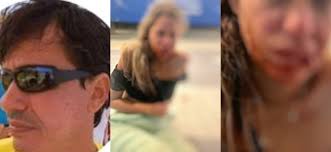 VIOLÊNCIA DOMÉSTICA: Empresário teria agredido companheira em condomínio de  luxo de JP