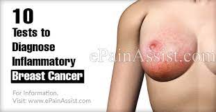 These are the questions which you can ask to rule out contraindications. 10 Tests To Diagnose Inflammatory Breast Cancer