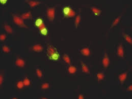 Image result for Chlamydia Trachomatis