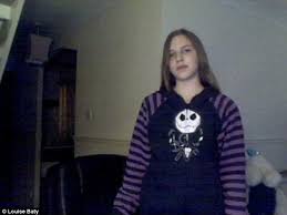 Teenager dies after surgery to correct sunken hollow in her chest