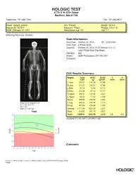 Hologic Body Composition Report Sample