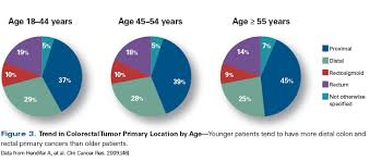 Colon cancer is the third most common cancer in men and women in the u.s. The Growing Challenge Of Young Adults With Colorectal Cancer